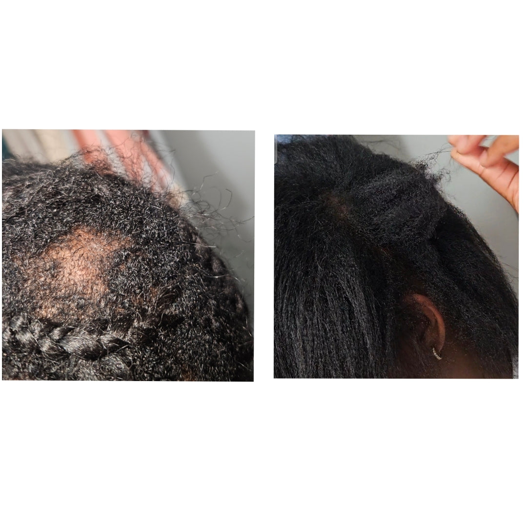 Root Revival Hair Growth and Scalp Oil- Infused with Herbs